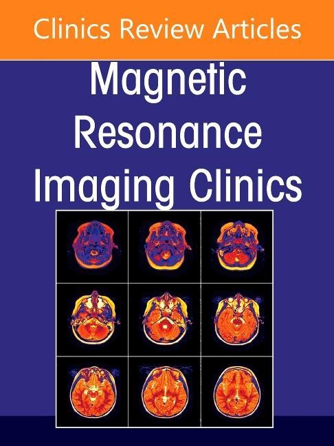 Carte MR Imaging of The Knee, An Issue of Magnetic Resonance Imaging Clinics of North America Mary K. Jesse