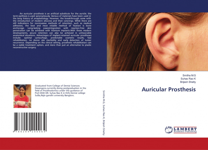 Knjiga Auricular Prosthesis Suhas Rao K