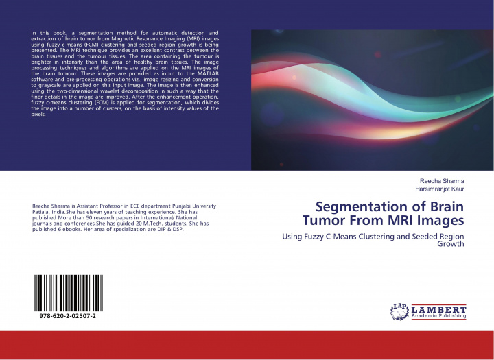 Knjiga Segmentation of Brain Tumor From MRI Images Harsimranjot Kaur