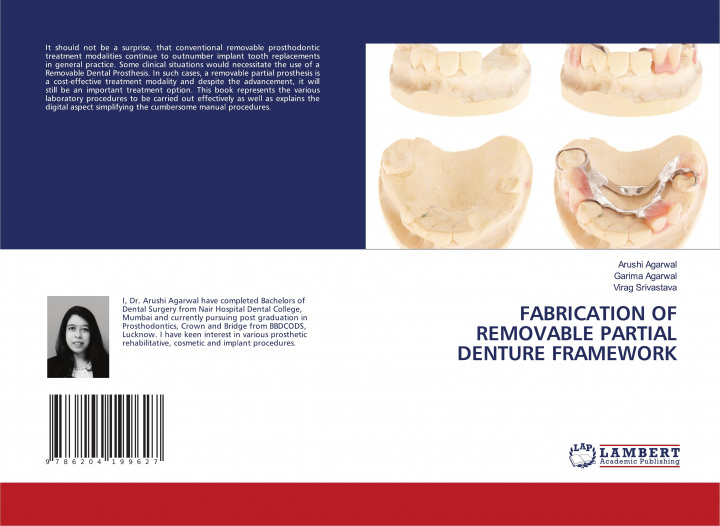 Book FABRICATION OF REMOVABLE PARTIAL DENTURE FRAMEWORK Garima Agarwal