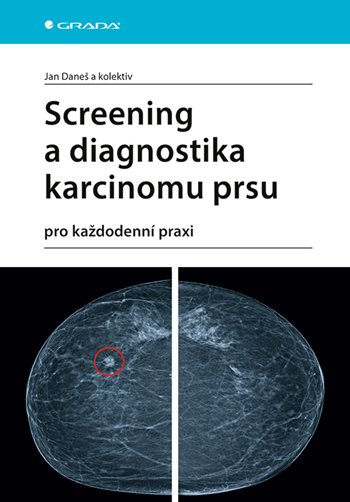 Book Screening a diagnostika karcinomu prsu Jan Daneš