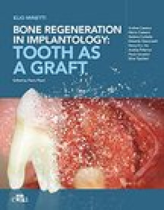 Könyv Bone regeneration in implantology - tooth as a graft Elio Minetti