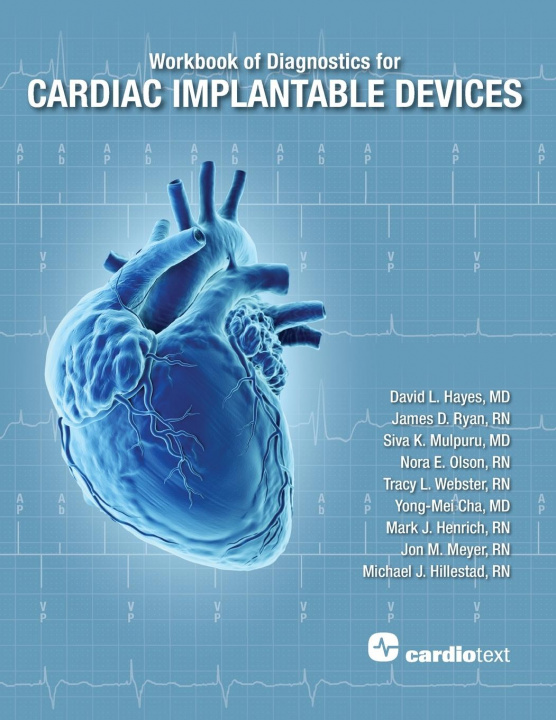 Книга Workbook of Diagnostics for Cardiac Implantable Devices James Ryan