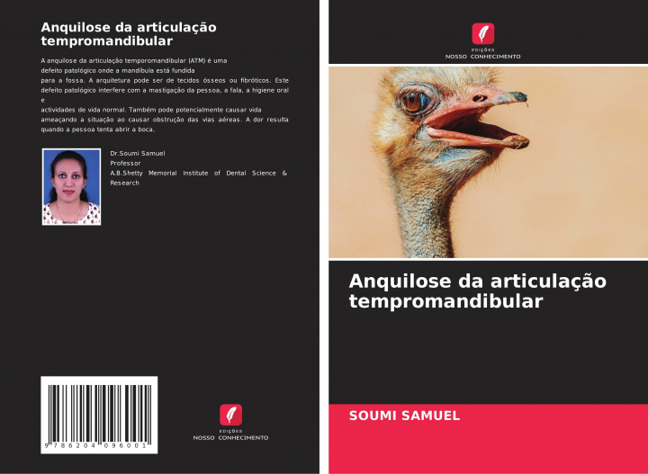 Livro Anquilose da articulacao tempromandibular SOUMI SAMUEL