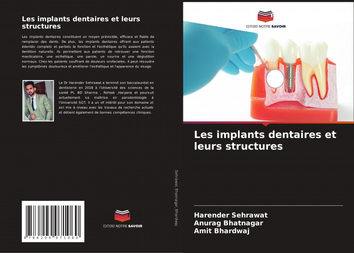 Kniha Les implants dentaires et leurs structures Anurag Bhatnagar