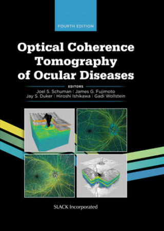 Książka Optical Coherence Tomography of Ocular Diseases Joel S. Schuman