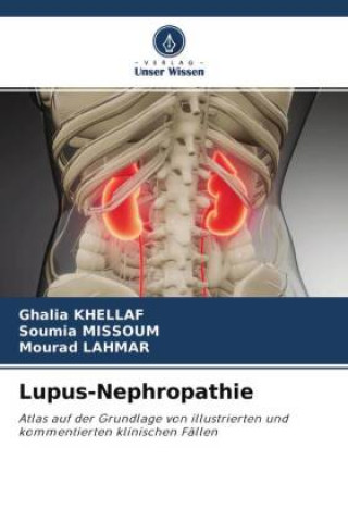 Książka Lupus-Nephropathie Soumia Missoum