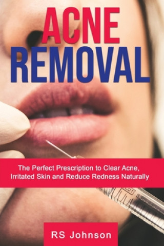 Libro Acne Removal Rs Johnson