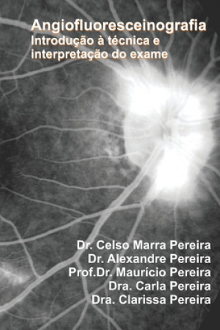Knjiga Angiofluoresceinografia Celso Pereira