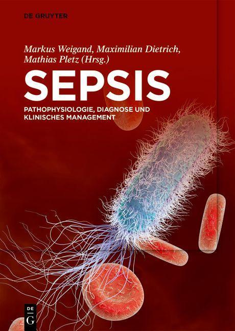Knjiga Sepsis Maximilian Dietrich
