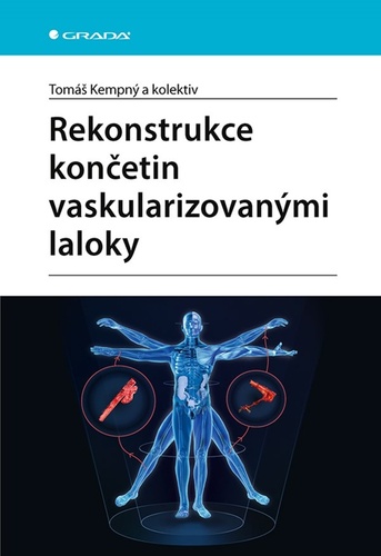 Könyv Rekonstrukce končetin vaskularizovanými laloky Tomáš Kempný