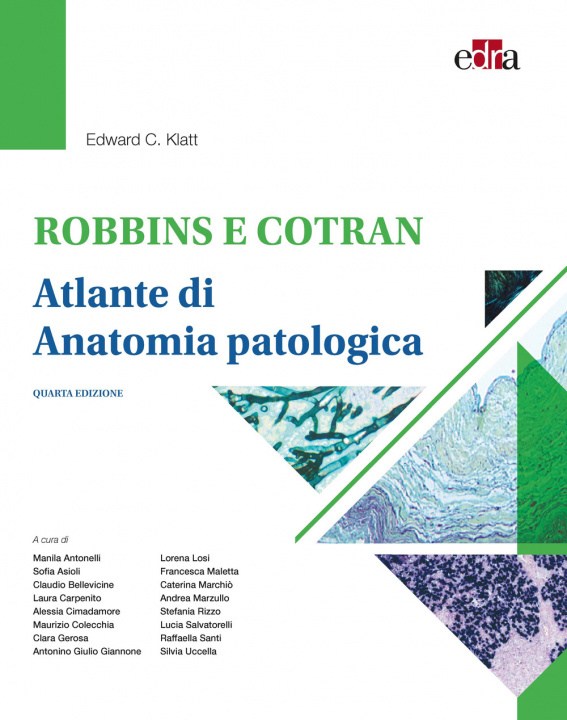 Könyv Robbins e Cotran. Atlante di anatomia patologica Edward C. Klatt