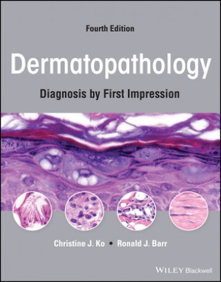 Kniha Dermatopathology: Diagnosis by First Impression, Fourth Edition Christine J. Ko