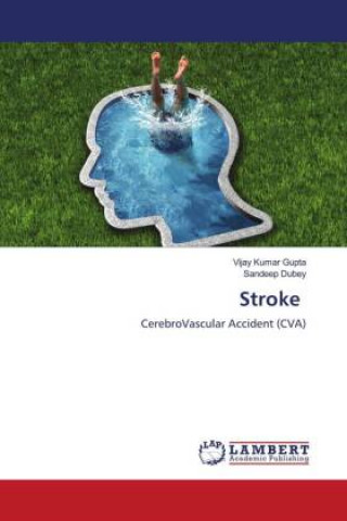 Книга Stroke Sandeep Dubey