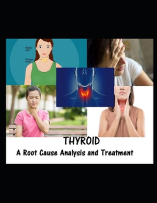 Knjiga Thyroid Ravi Kiran