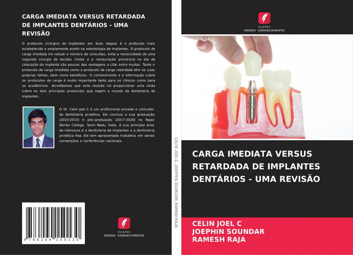 Kniha Carga Imediata Versus Retardada de Implantes Dentarios - Uma Revisao Joephin Soundar