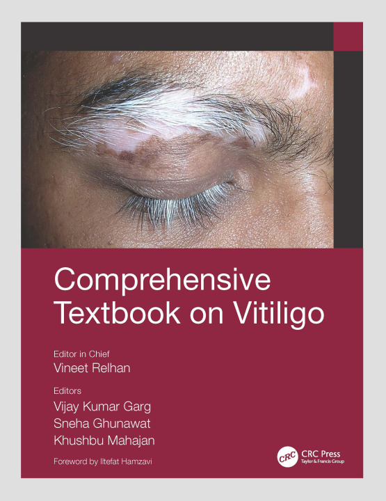 Könyv Comprehensive Textbook on Vitiligo 