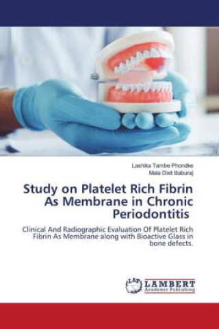 Książka Study on Platelet Rich Fibrin As Membrane in Chronic Periodontitis Mala Dixit Baburaj