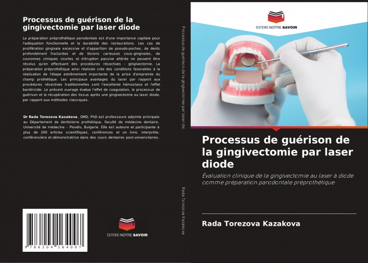 Kniha Processus de guerison de la gingivectomie par laser diode Rada Torezova Kazakova
