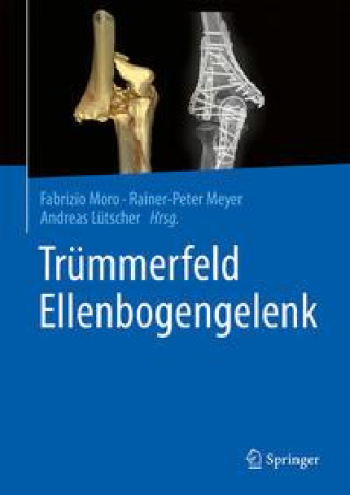 Книга Trummerfeld Ellenbogengelenk Rainer-Peter Meyer