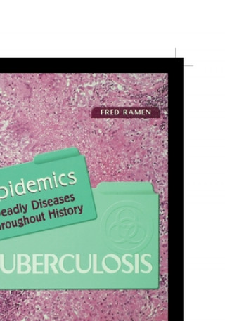 Book Tuberculosis Fred Ramen
