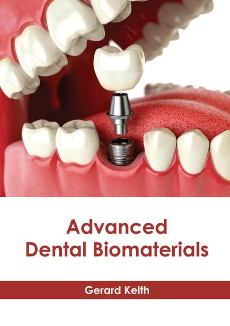 Kniha Advanced Dental Biomaterials 
