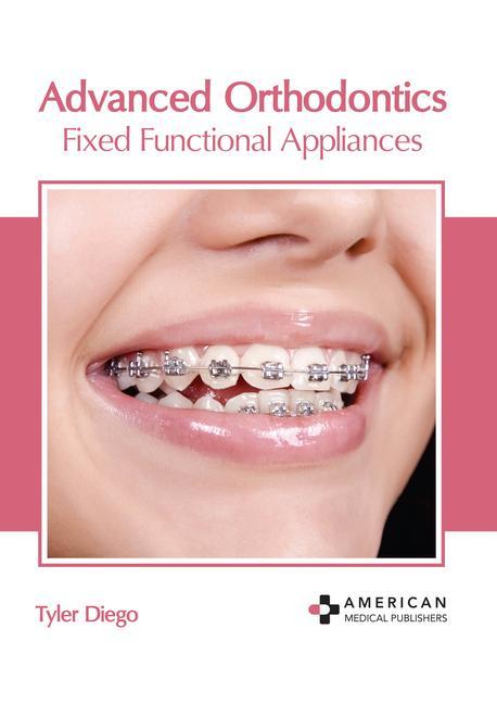 Könyv Advanced Orthodontics: Fixed Functional Appliances 