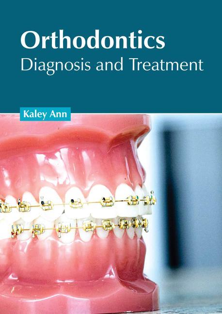 Kniha Orthodontics: Diagnosis and Treatment 