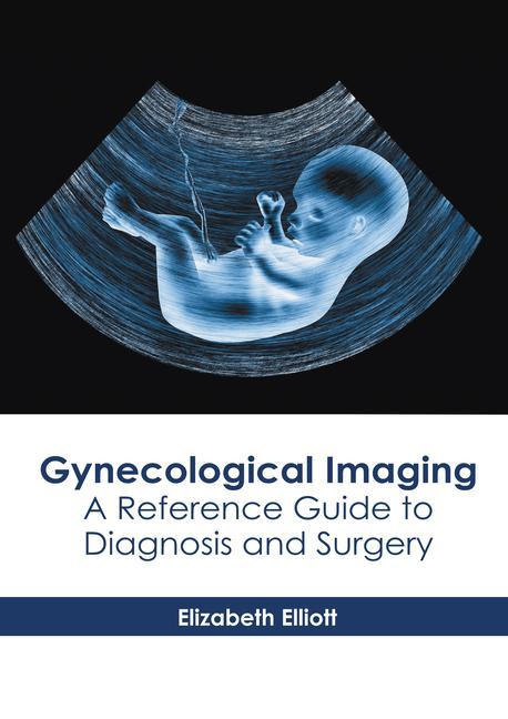 Knjiga Gynecological Imaging: A Reference Guide to Diagnosis and Surgery Elizabeth Elliott