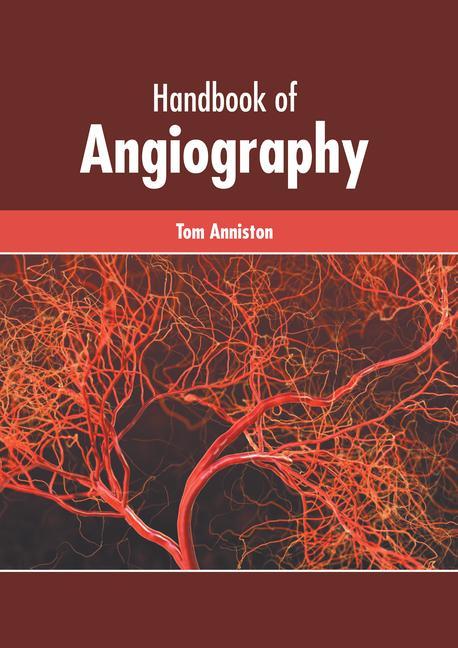 Knjiga Handbook of Angiography 