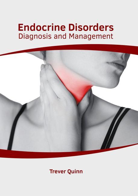 Książka Endocrine Disorders: Diagnosis and Management 