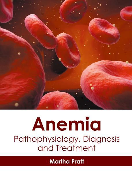 Kniha Anemia: Pathophysiology, Diagnosis and Treatment 