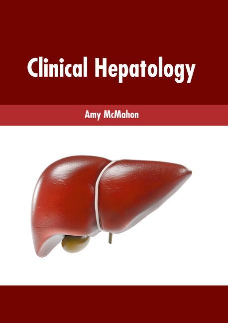 Kniha Clinical Hepatology 