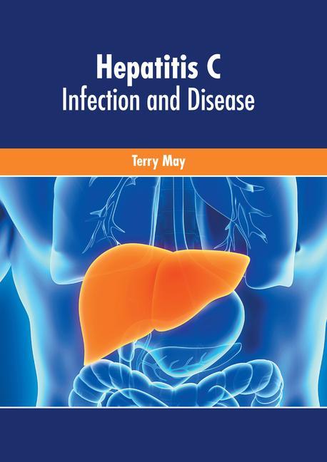Kniha Hepatitis C: Infection and Disease 
