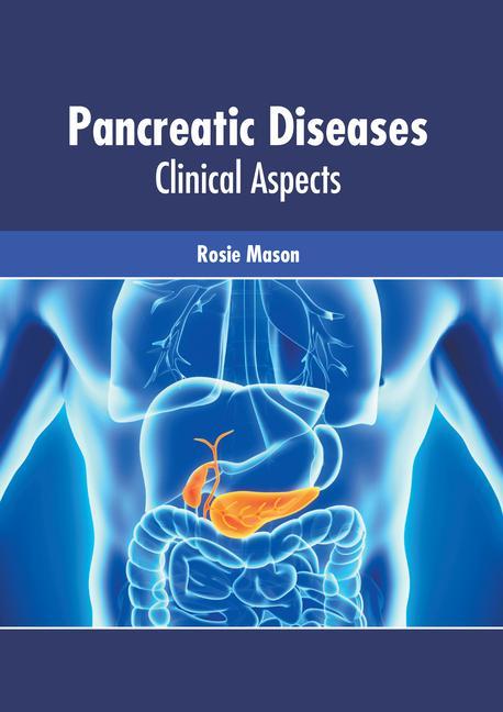 Kniha Pancreatic Diseases: Clinical Aspects 