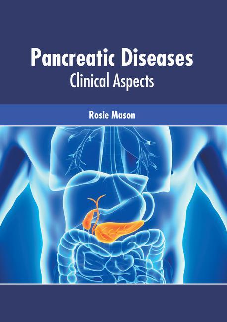 Książka Pancreatic Diseases: Clinical Aspects 