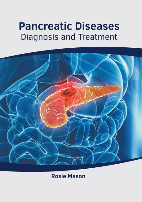 Kniha Pancreatic Diseases: Diagnosis and Treatment 