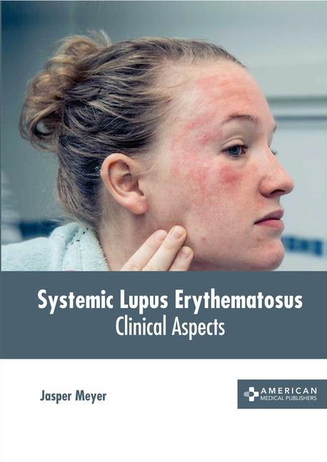 Kniha Systemic Lupus Erythematosus: Clinical Aspects 