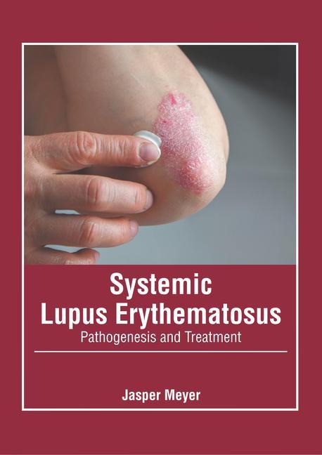 Könyv Systemic Lupus Erythematosus: Pathogenesis and Treatment 
