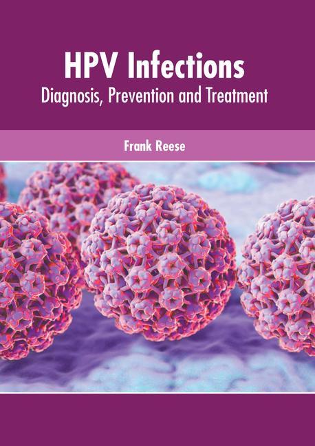 Kniha Hpv Infections: Diagnosis, Prevention and Treatment 