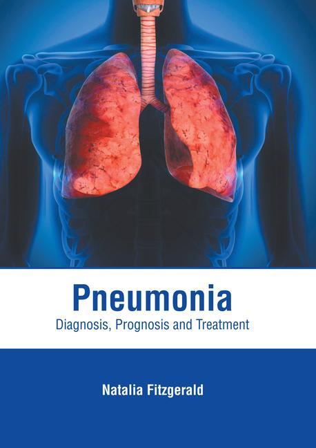 Könyv Pneumonia: Diagnosis, Prognosis and Treatment 