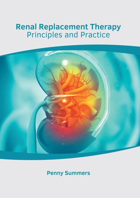 Książka Renal Replacement Therapy: Principles and Practice 