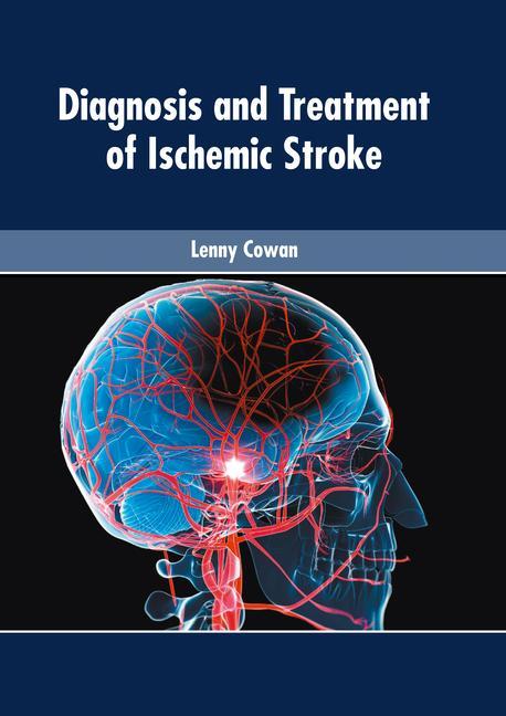 Kniha Diagnosis and Treatment of Ischemic Stroke 