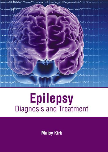 Könyv Epilepsy: Diagnosis and Treatment 