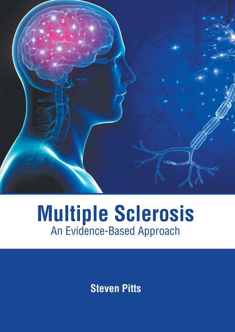 Knjiga Multiple Sclerosis: An Evidence-Based Approach 