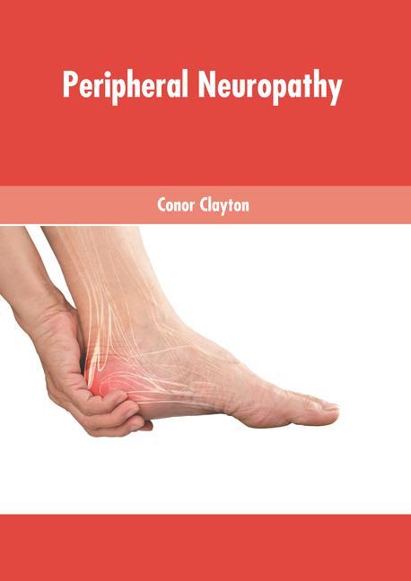 Könyv Peripheral Neuropathy 