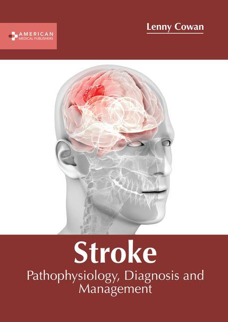 Книга Stroke: Pathophysiology, Diagnosis and Management 