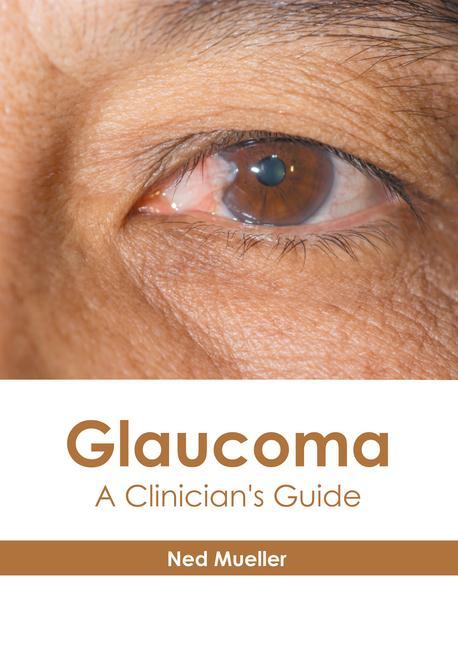 Könyv Glaucoma: A Clinician's Guide 