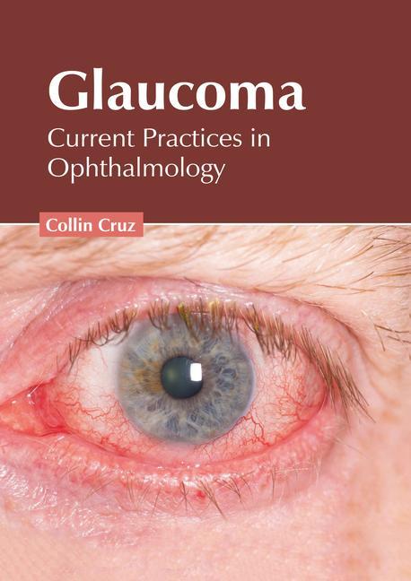Könyv Glaucoma: Current Practices in Ophthalmology 