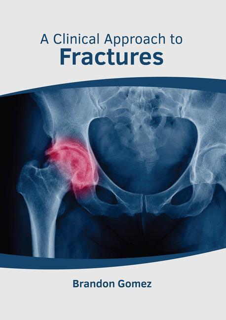 Knjiga Clinical Approach to Fractures Brandon Gomez